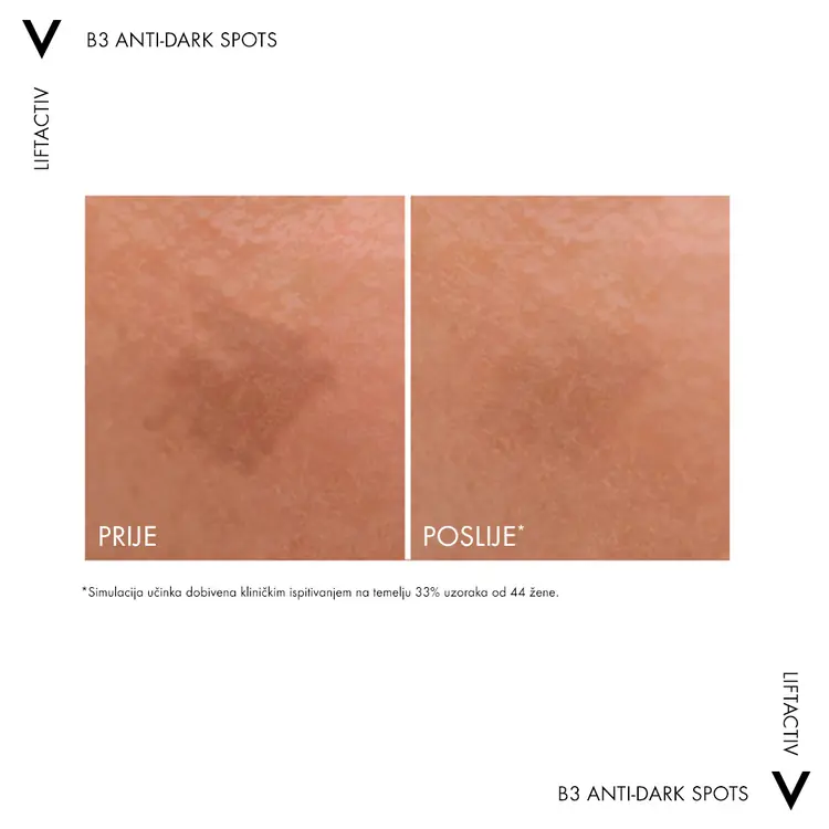 Vichy Liftactiv Specialist B3 dark spots serum 30 ml