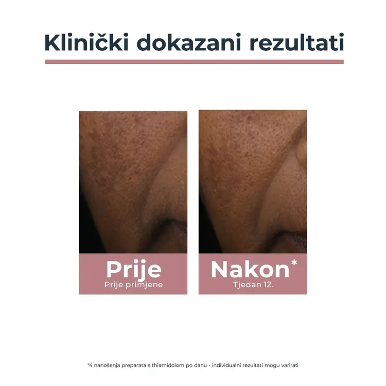 Eucerin Anti-Pigment spot korektor 5 ml