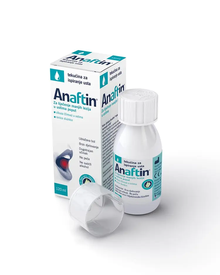 Anaftin tekućina za ispiranje usta, za liječenje manjih lezija u ustima, 120 ml