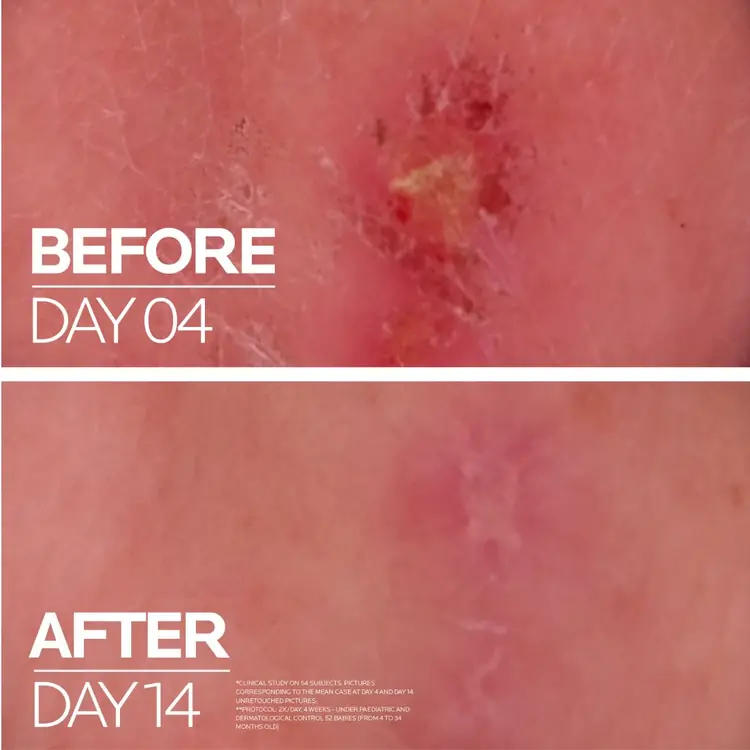 La Roche-Posay Cicaplast Baume B5+, 40 ml