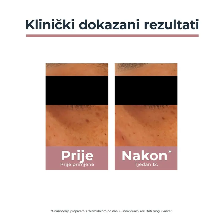 Eucerin Anti-Pigment krema za područje oko očiju, 15 ml