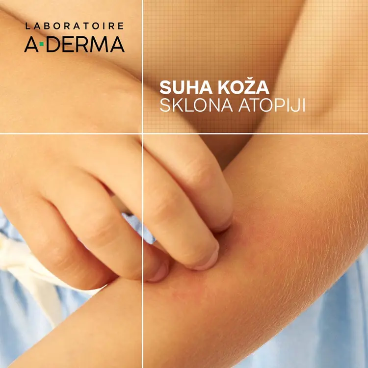 A-Derma Exomega Control emolijentni balzam za suhu i iritiranu kožu, 200 ml
