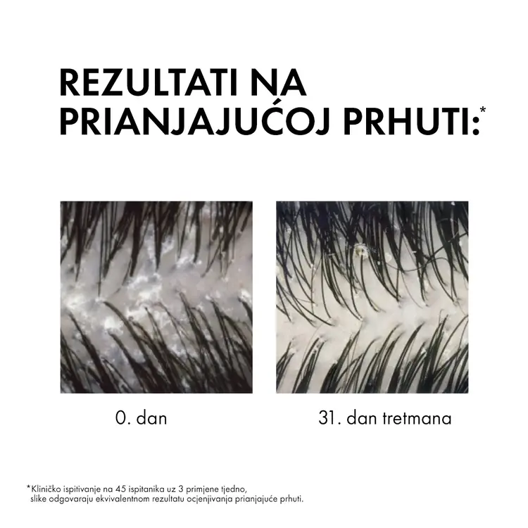 Vichy Dercos šampon protiv prhuti za normalnu ili masnu kosu 200 ml