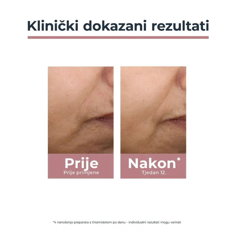 Eucerin Anti-Pigment dnevna tonirana njega SPF 30 (Tamna  nijansa), 50 ml