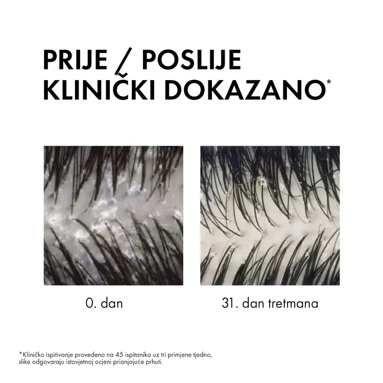 Vichy Dercos  šampon protiv prhuti DS  - 2 u 1: Dermokozmetički šampon i regenerator, 200 ml