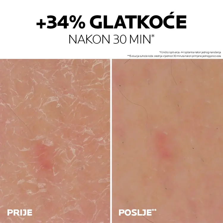 La Roche-Posay Lipikar Gel Urea 30%, 50 ml