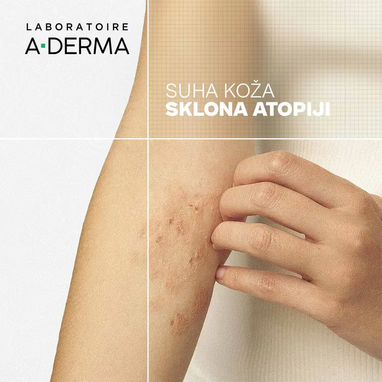 A-Derma Exomega Control emolijentna krema, 400 ml