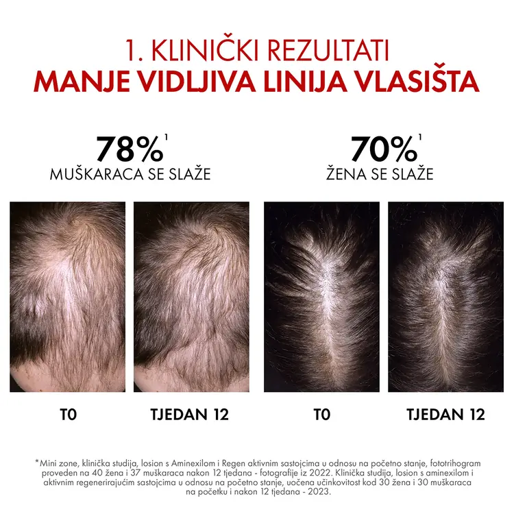 Vichy Dercos Aminexil Clinical  Regen Booster, 90ml