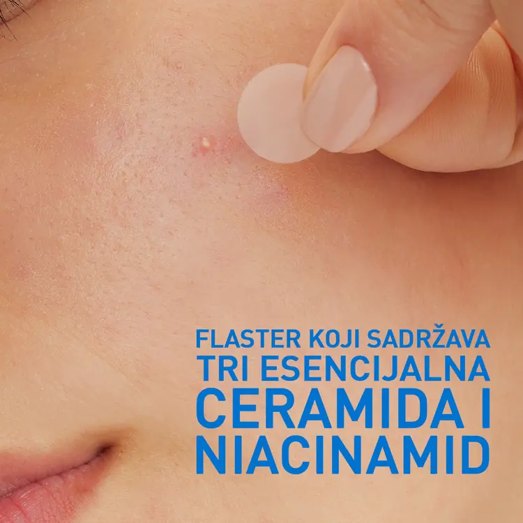 CeraVe Flasteri protiv nepravilnosti, 22 komada