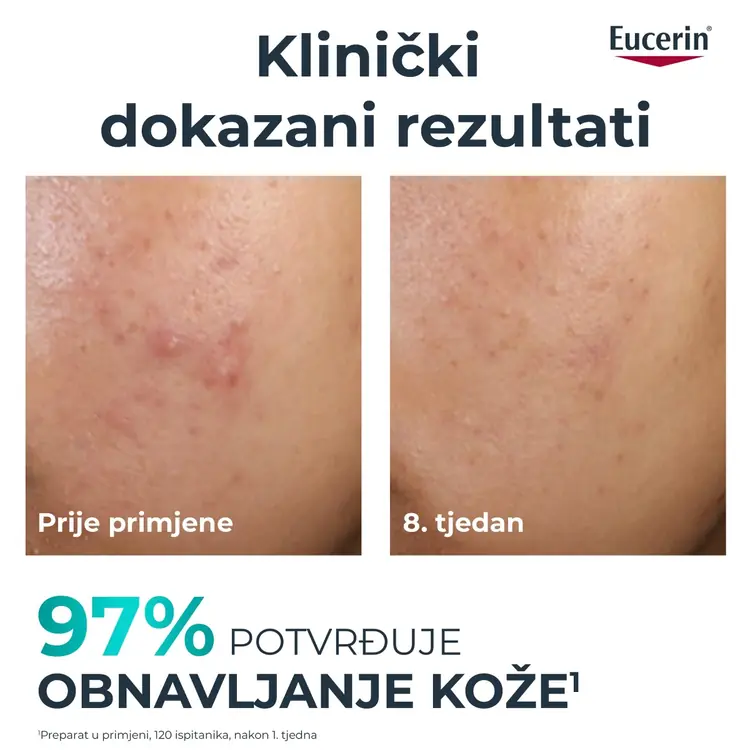 Eucerin DermoPure Clinical piling, 40 ml