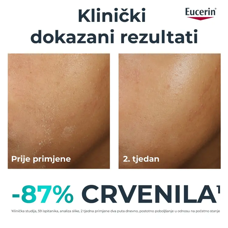 Eucerin Dermopure Clinical dopunska umirujuća krema, 40 ml