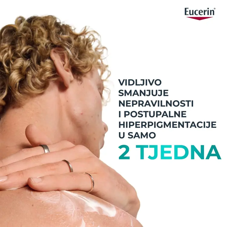 Eucerin DermoPure Clinical losion za tijelo s trostrukim djelovanjem, 200 ml