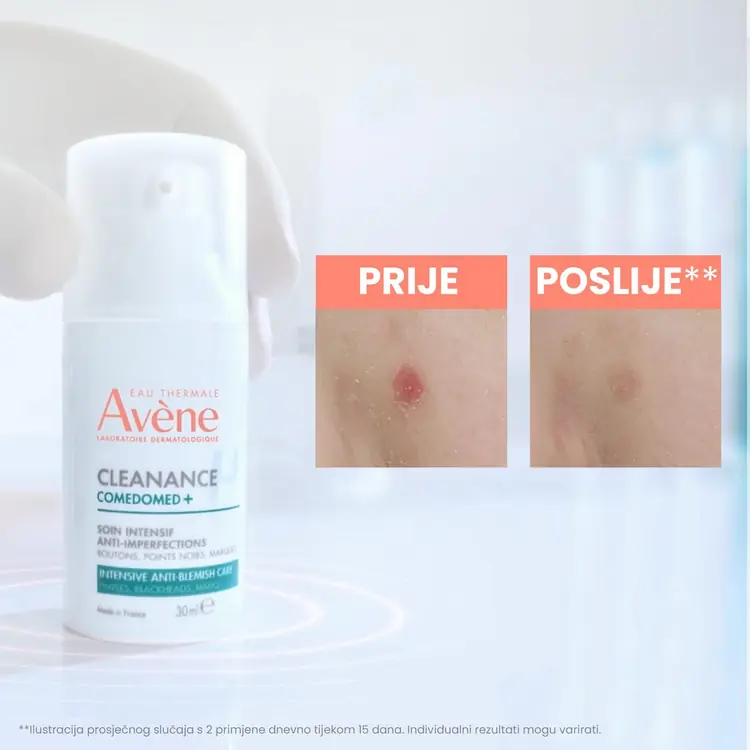 Eau Thermale Avène CLEANANCE COMEDOMED+
Intenzivna njega protiv nepravilnosti, 30 ml
