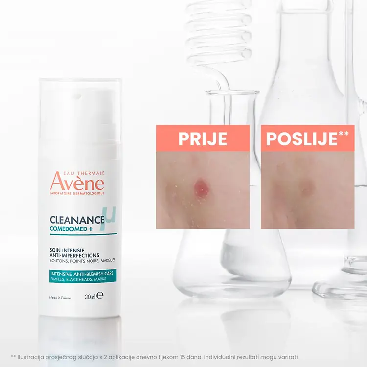 Eau Thermale Avène CLEANANCE COMEDOMED+Intenzivna njega protiv nepravilnosti, 30 ml
