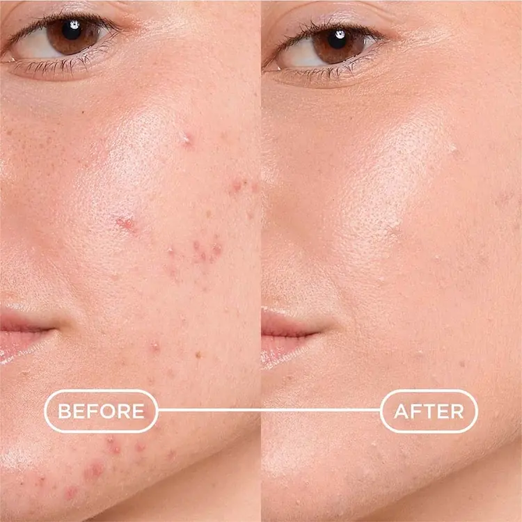 Bioderma Sébium Kerato+ Cover, 30 ml