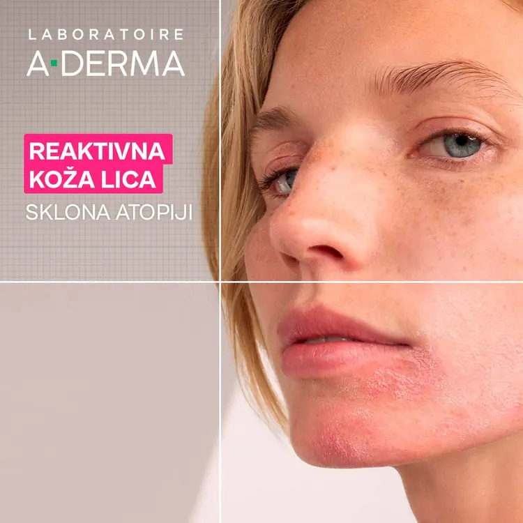 A-Derma Exomega umirujuća gel-krema za lice, 40 ml