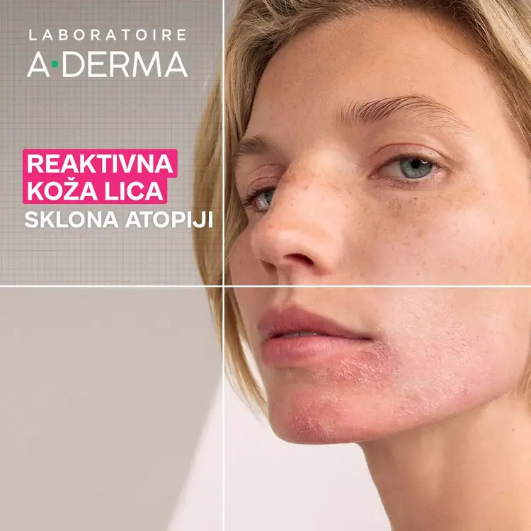 A-Derma Exomega umirujući balzam za kapke, 15 ml