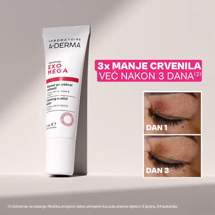 A-Derma Exomega umirujući balzam za kapke, 15 ml