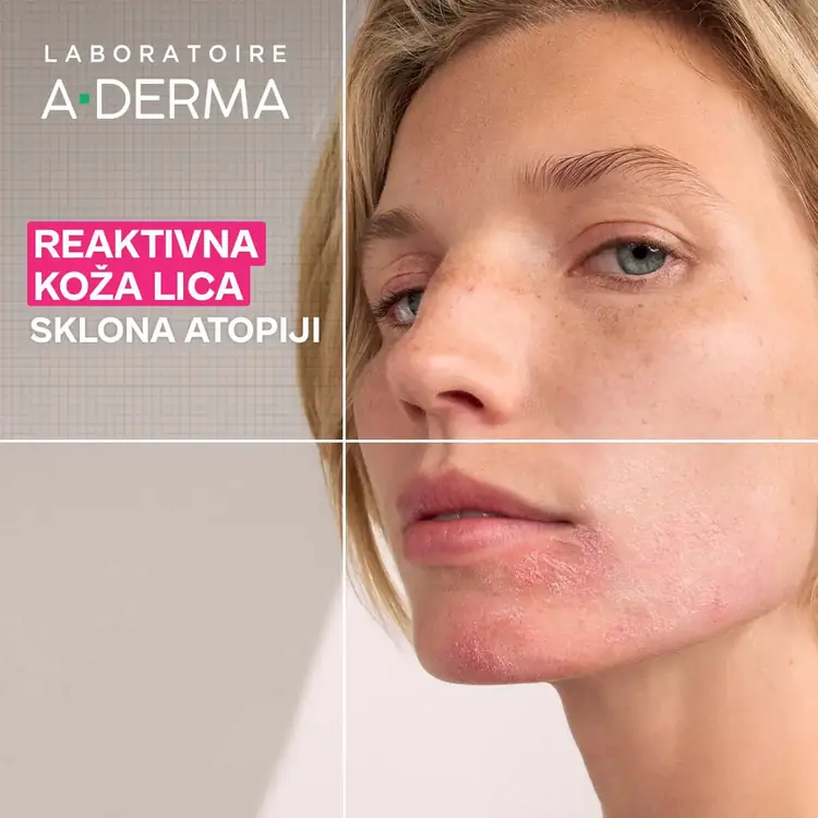 A-Derma Exomega umirujući gel za čišćenje lica, 200 ml