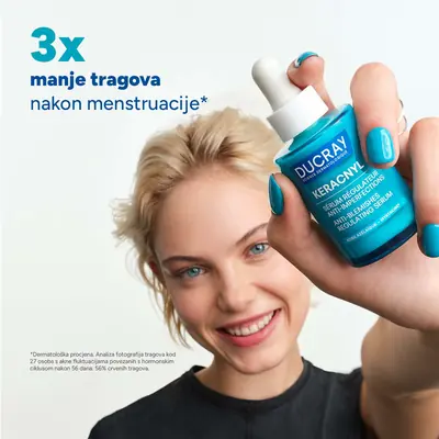 Ducray Keracnyl regulirajući serum protiv nepravilnosti, 30 ml-03