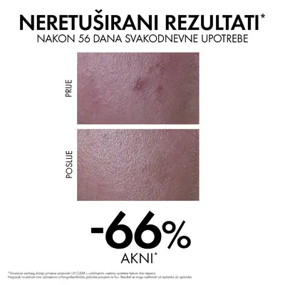Vichy Capital Soleil UV-Clear Fluid protiv nepravilnosti SPF50+ 40 ml