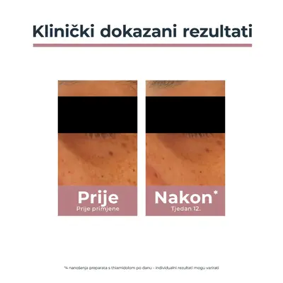 Eucerin Anti-Pigment krema za područje oko očiju, 15 ml