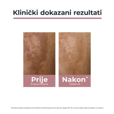 Eucerin Anti-Pigment noćna njega 50 ml