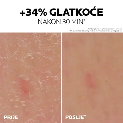 La Roche-Posay Lipikar Gel Urea 30%, 50 ml