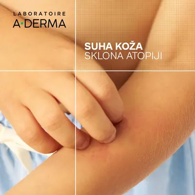 A-Derma Exomega Control emolijentni balzam protiv grebanja, 400 ml