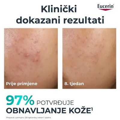 Eucerin DermoPure Clinical piling, 40 ml
