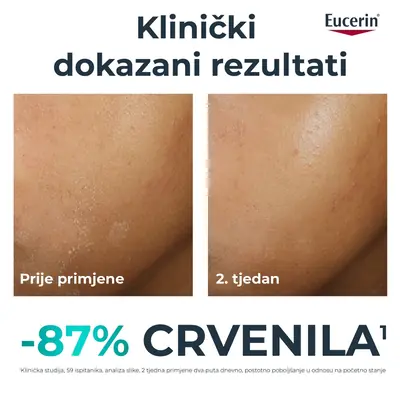 Eucerin Dermopure Clinical dopunska umirujuća krema, 40 ml