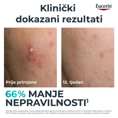 Eucerin DermoPure Clinical serum s trostrukim djelovanjem, 40 ml