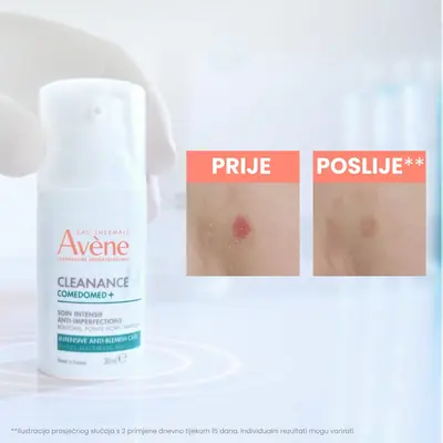 Eau Thermale Avène CLEANANCE COMEDOMED+
Intenzivna njega protiv nepravilnosti, 30 ml