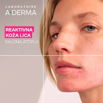 A-Derma Exomega umirujuća gel-krema za lice, 40 ml
