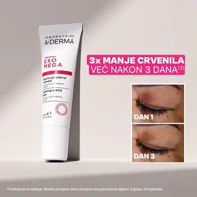A-Derma Exomega umirujući balzam za kapke, 15 ml